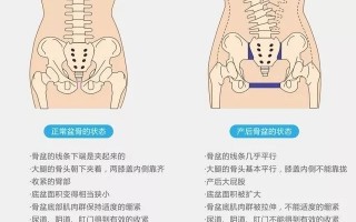 每个产妇都要做“骨盆修复”？这个市场太黑了！