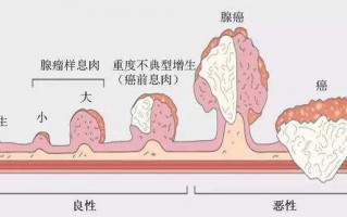 一封来自息肉的认罪书