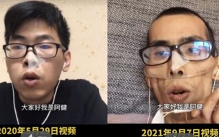 患癌症后骨瘦如柴？该吃哪些食物？不能吃哪些食物？