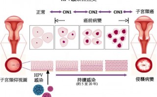 9价比4价更好吗？专家解答HPV疫苗6大问题！