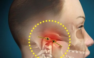 颞下颌关节紊乱综合征如何治疗？