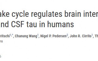 Science：不好好睡觉小心得痴呆