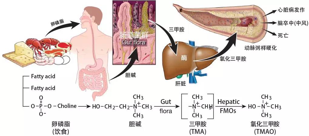 令人震惊的卵磷脂、肠道菌群和心血管疾病.jpg