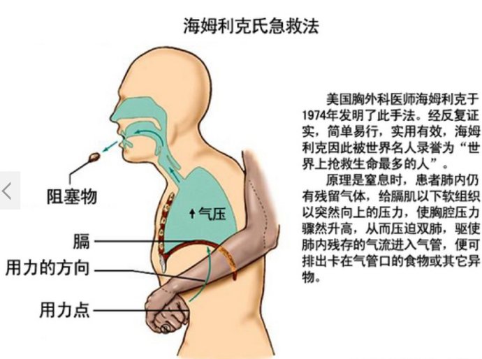 海姆立克急救法原理.jpg/