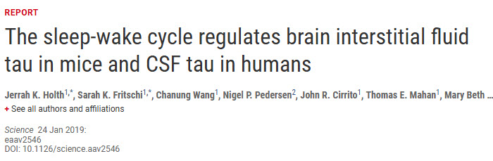 Science：不好好睡觉小心得痴呆.jpg/