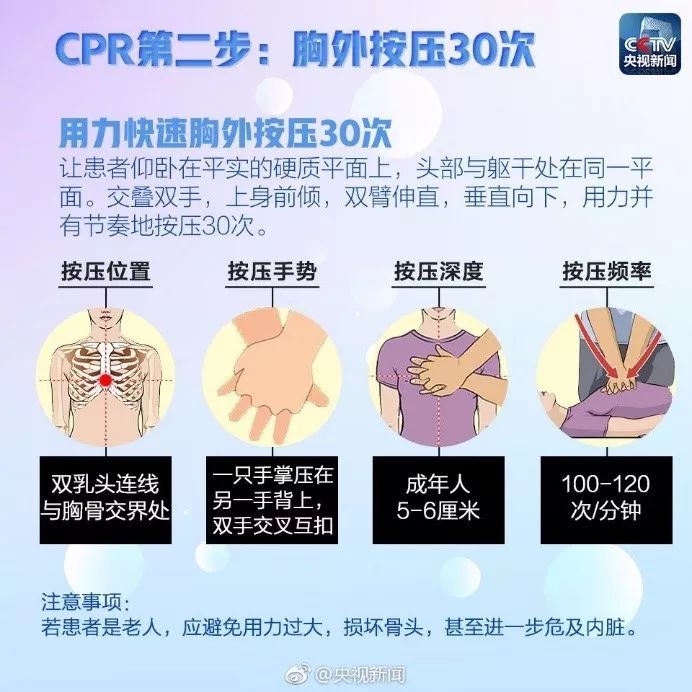 心肺复苏（CPR）02.jpeg/