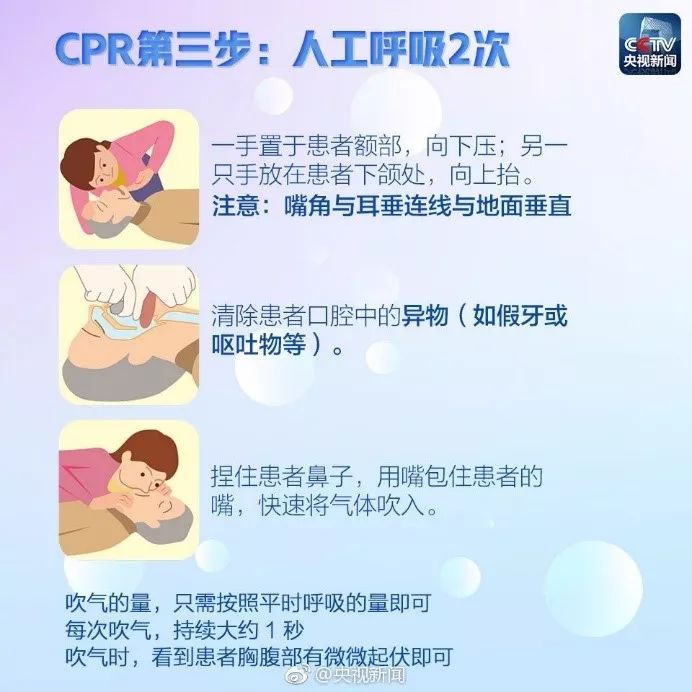 心肺复苏（CPR）03.jpeg/