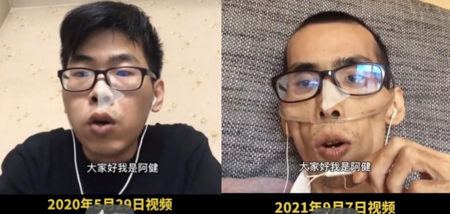 抗癌网红博主阿健.png